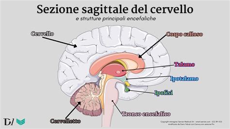 Schema di un tumore cranico che comprime il tronco encefalico