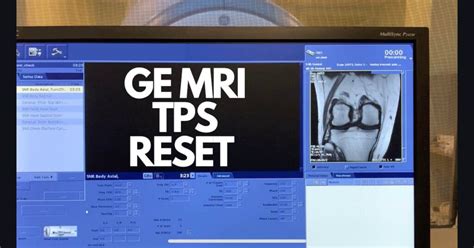TPS reset grafico workflow (finestra diagnosi)