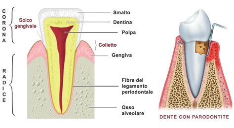 Diagramma che illustra il colletto igienico di una corona dentale